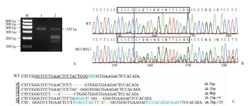 碱性亮氨酸拉链的介入，会对青钱柳根茎发育产生多大影响？