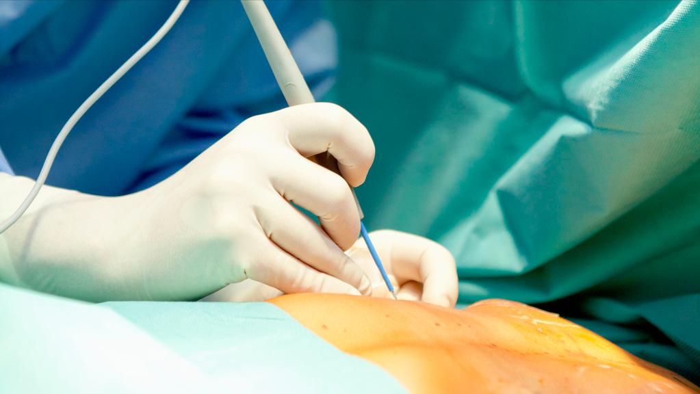 做隆胸手术还能正常喂奶吗,隆胸手术后还可以哺乳吗