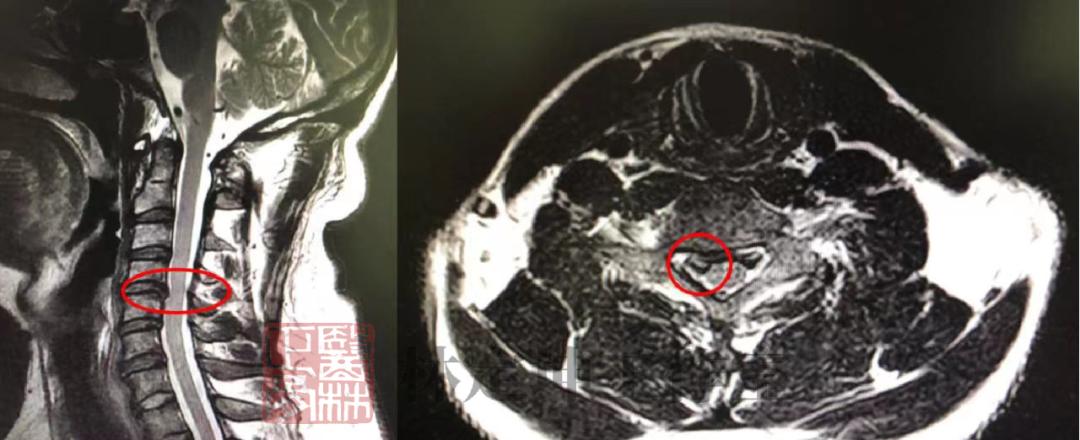骨科的三大谣言你都知道吗,医林正骨