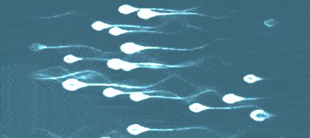 精子的活动轨迹讲解,精子的轨迹分析