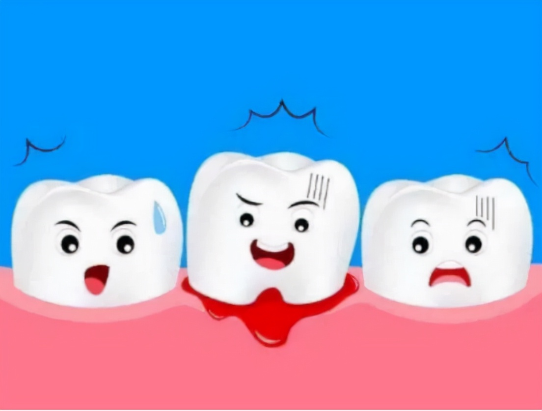 地平类降压药导致牙龈增生怎么办,吃氨氯地平降压药出现牙龈增生