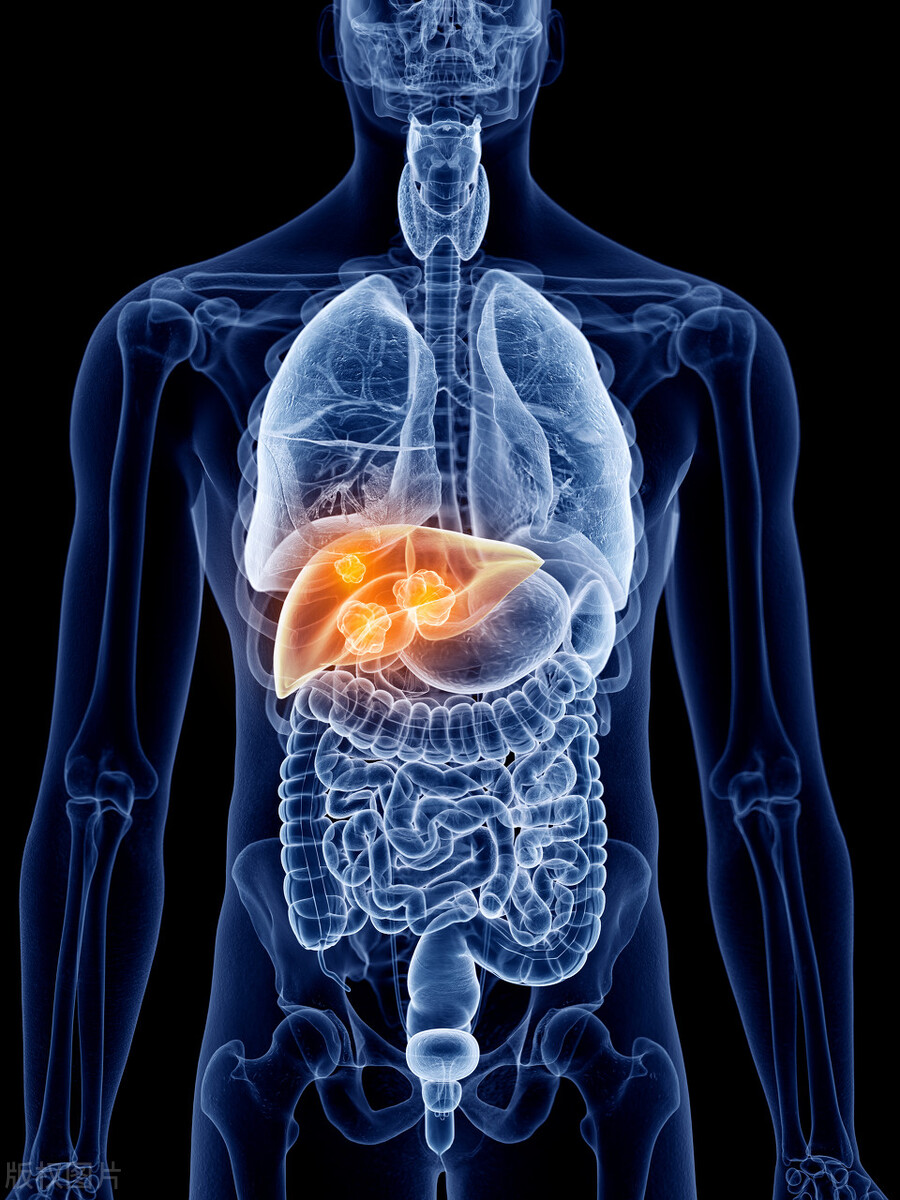 中医药如何治疗尿酸高,中医药如何治湿疹