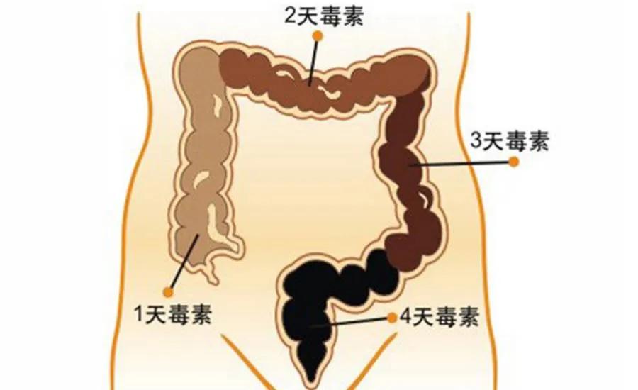 肠长了息肉有什么症状,肠里有息肉是怎么造成的