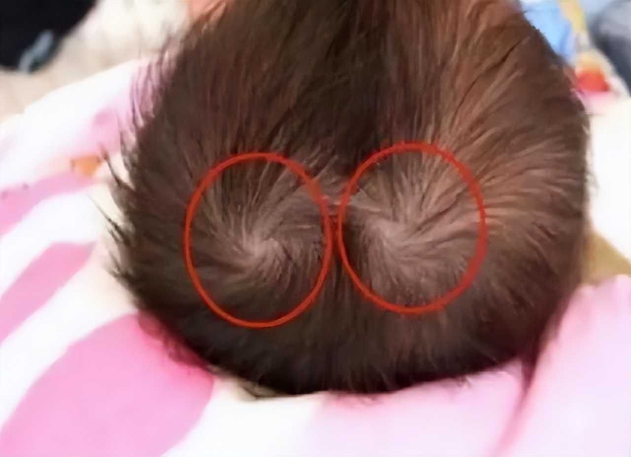 头上有两个旋智商高吗,孩子头上旋的个数暗示孩子智商