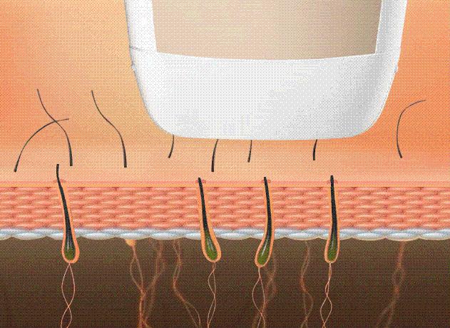 女生体毛多、长胡子、*处私**的毛又粗又长？或与这5个因素有关