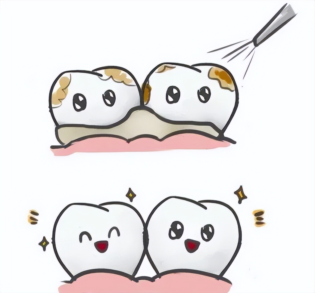 洗牙为什么特别难受,为什么洗牙感觉这么疼