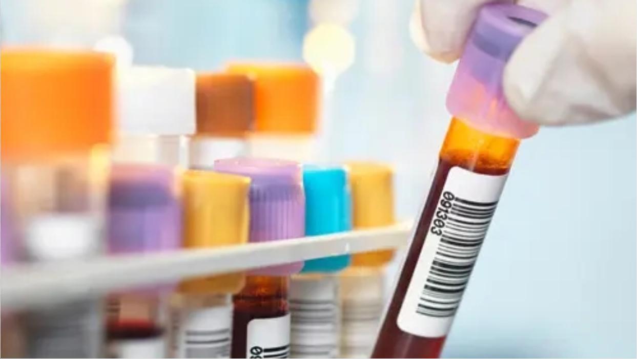 肾病高血压可以吃阿利沙坦酯,国产新药阿利沙坦酯保护心肾