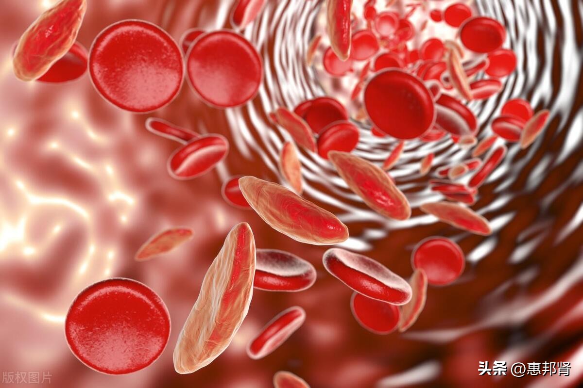 肾性贫血怎么补最快,肾性贫血会瘦吗
