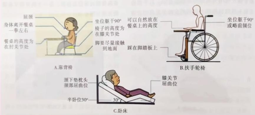 吞咽障碍不能吞咽怎么办,难言之隐吞咽障碍