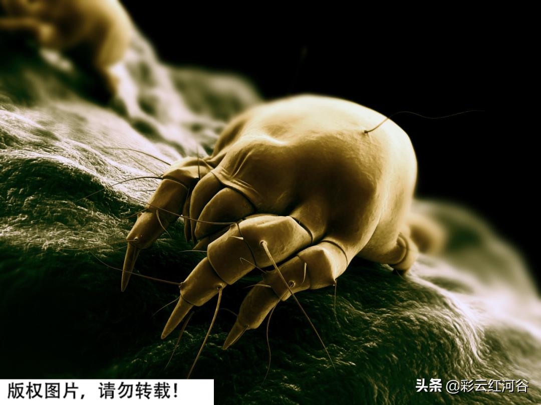 女子眼睛有虫子,眼睛干痒可能是眼睛里有虫