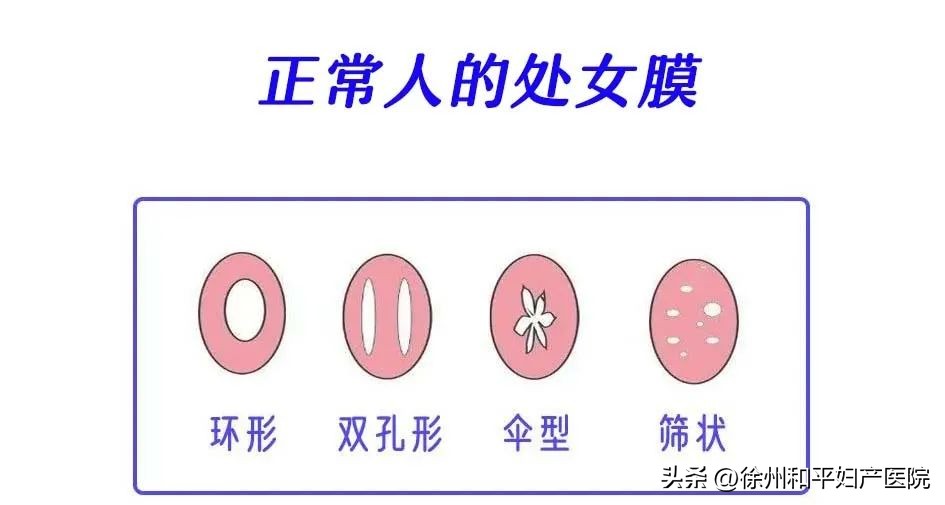 月经“堵”在阴道大半年，积了一瓶矿泉水那么多
