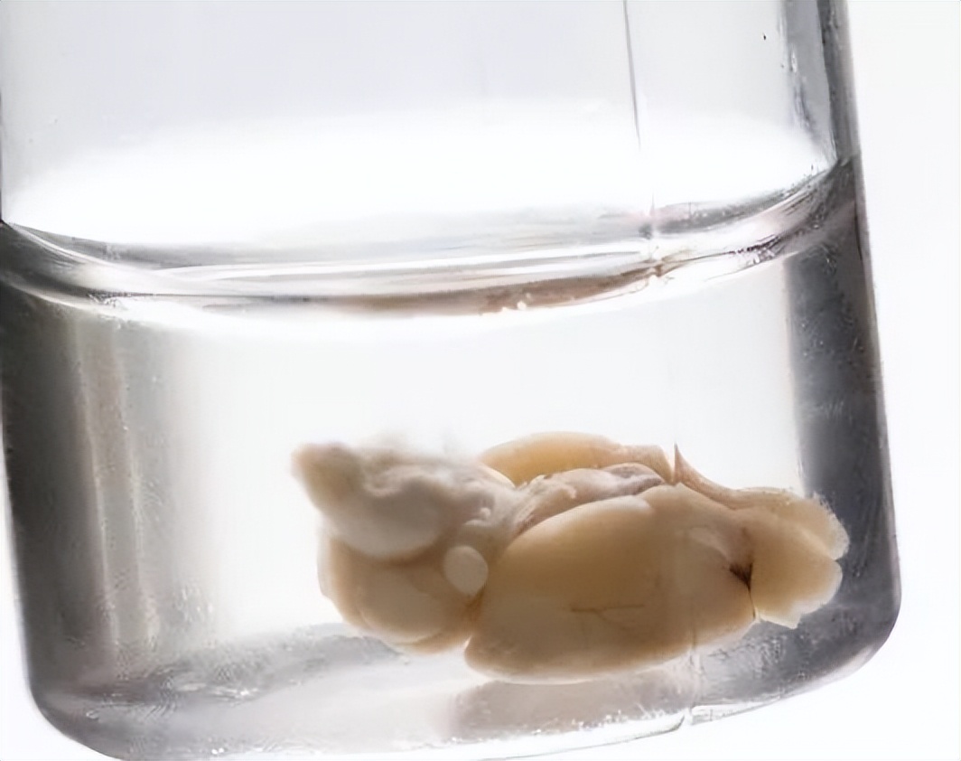 电击大脑可以提升记忆力吗,电击大脑可以忘记一个人吗