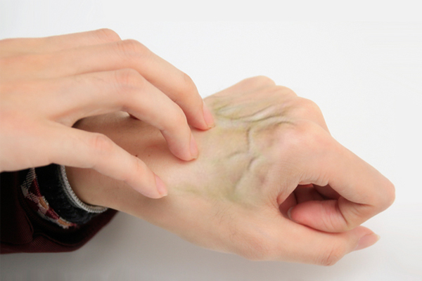 小臂青筋全部暴起是什么样的,手臂爆青筋是天生的吗