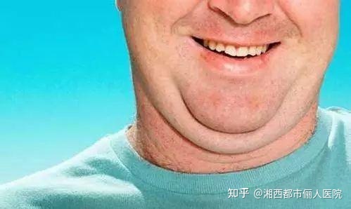 颈纹特别深怎么去除湘西都市俪人医院能做吗？