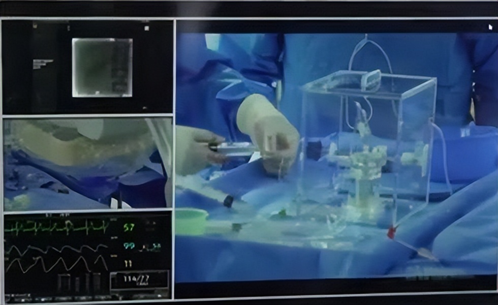 【重磅】抗癌新药钇90安家广州中医药大学金沙洲医院