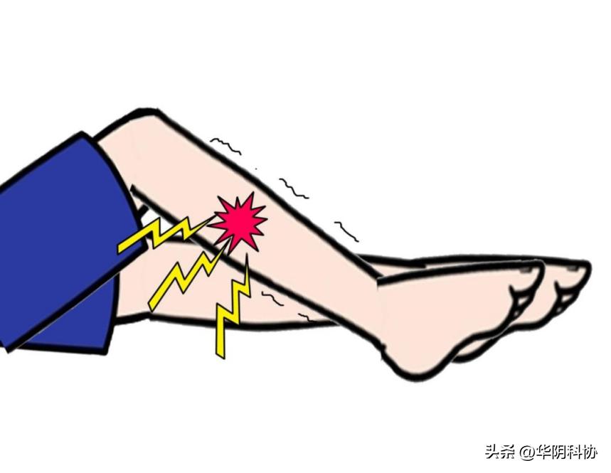 女性不安腿综合征图片,怎么确诊不安腿综合征