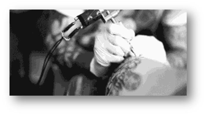 激光清洗的误区,洗纹身五大误区照片