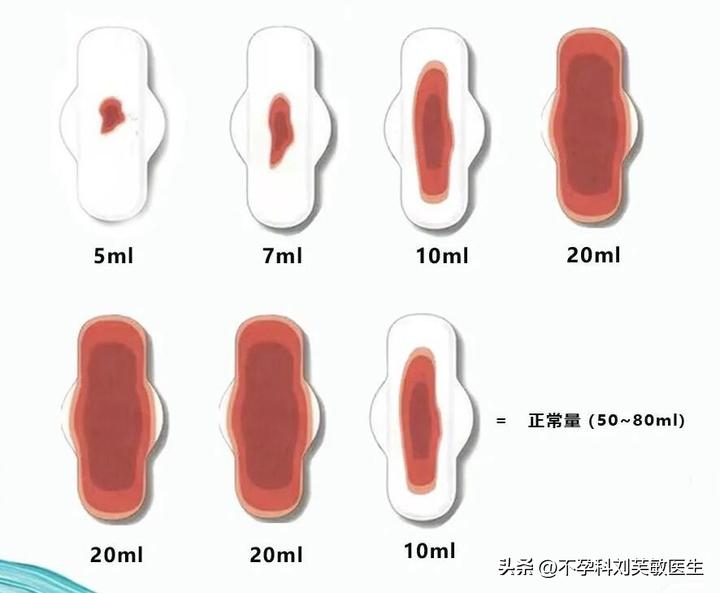 月经有血块跟痛经有关系吗,月经推迟痛经