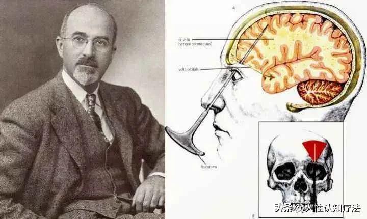 心理治疗起源,罗杰斯的心理治疗