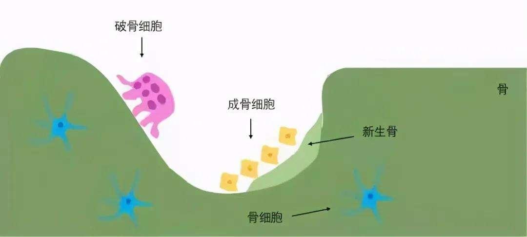 骨质疏松多长时间查一次骨密度,骨质疏松骨密度减少吃什么药