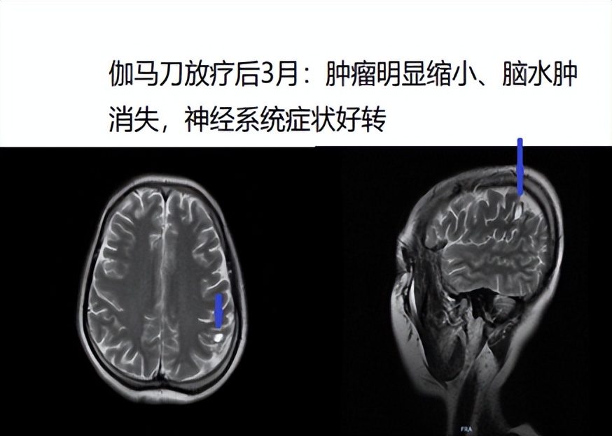 高质量发展！前进中的河北工程大学附属医院肿瘤中心