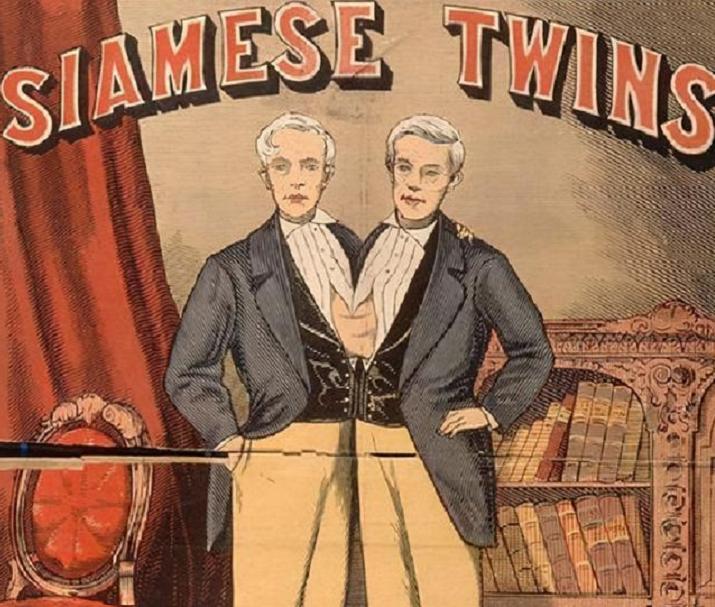 连体人娶妻生子,连体人如何生子