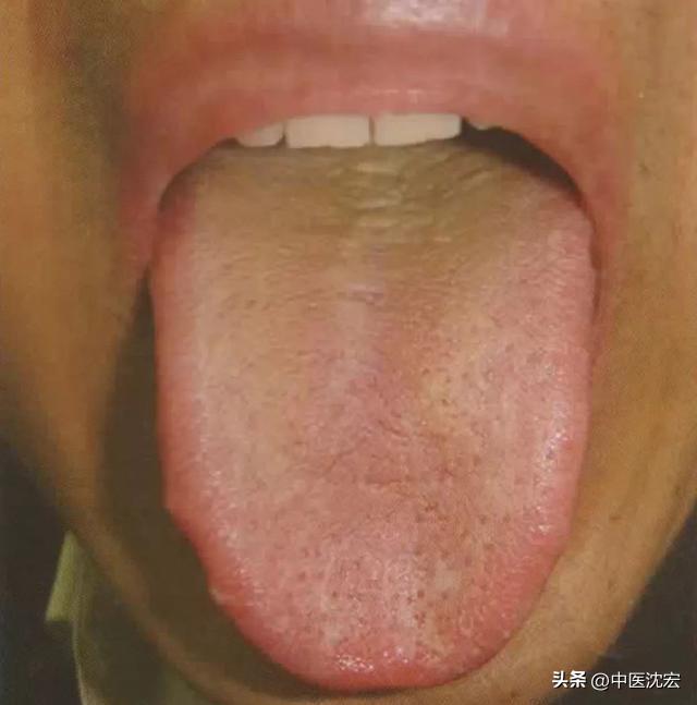 治脾不治肝,养肝疏肝调理脾胃的中成药