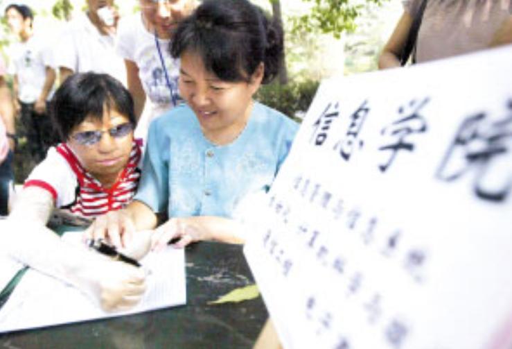 15岁妙龄少女被烧伤,19岁花季少女被烧伤后续