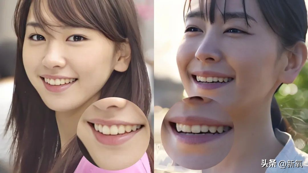 牙齿正畸和骨骼正畸的区别,牙齿正畸和眼轴增长有关系吗