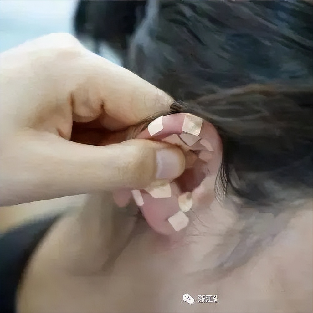 表情不受管理怎么办,表情不受控制是什么病