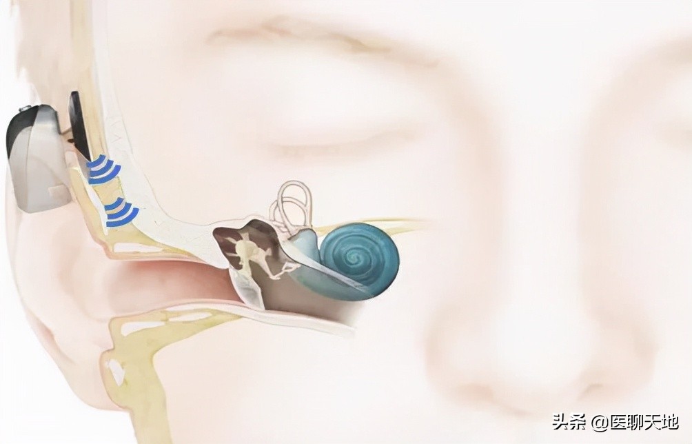 有医说医|先天性小耳畸形治疗，听力功能提高需同步