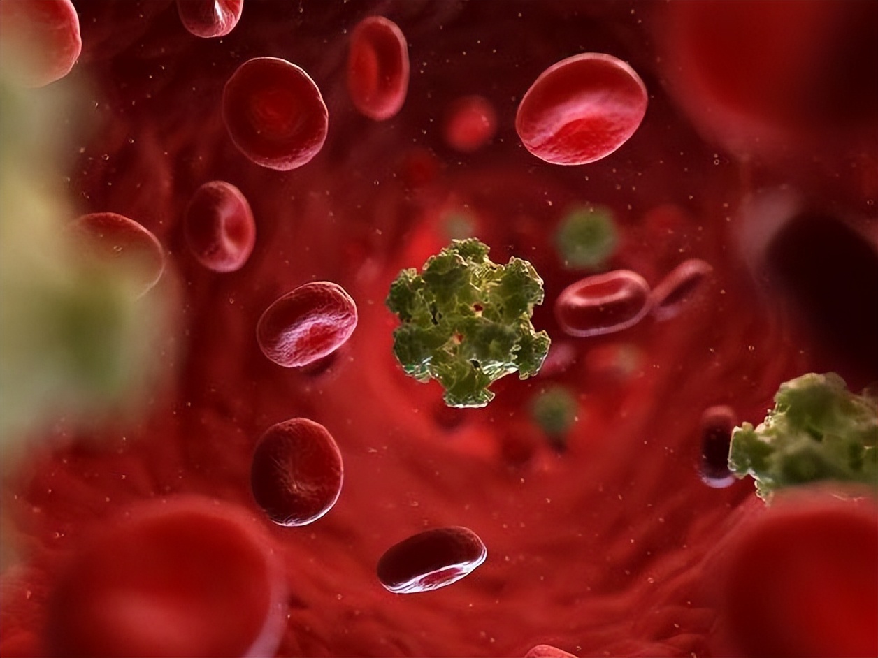 有宫颈病变会有什么症状,女性宫颈病变的原因