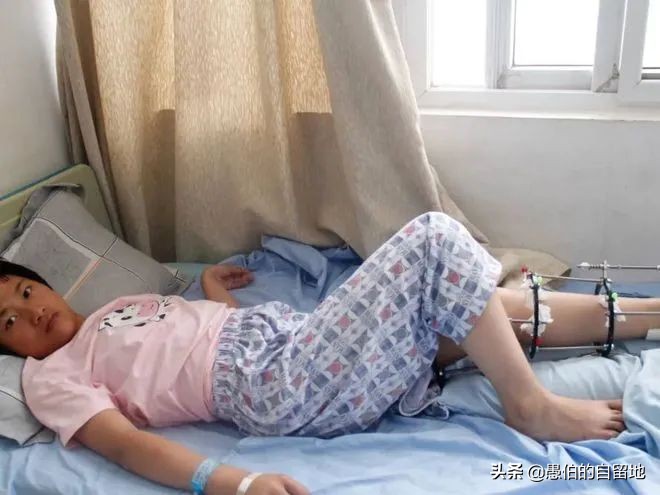 早产儿得脑瘫的几率高吗,早产儿得脑瘫的几率大么