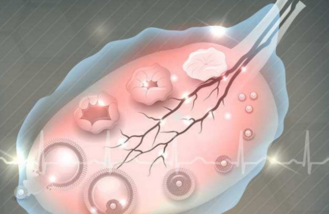 女性出血的原因及解决方法,女性出血是什么原因引起的