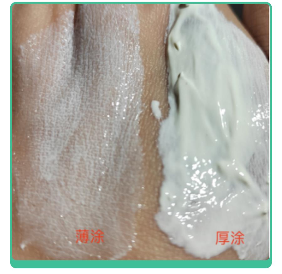 儿童蚊虫叮咬止痒用青草膏好吗,红屁屁过敏用什么药膏