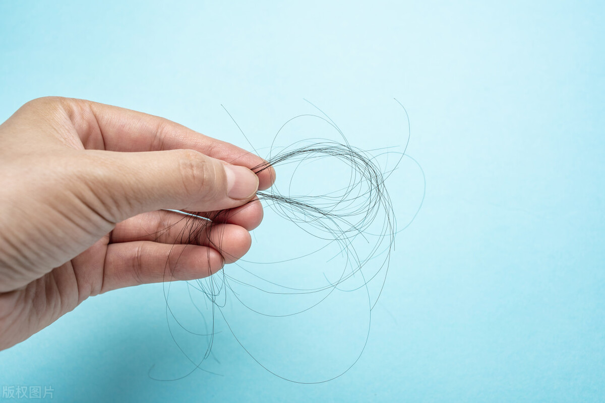 是什么导致毛发旺盛的,为什么身上的毛发比较旺盛