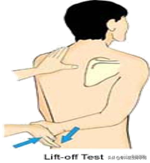 肩袖损伤诊断及关节镜下治疗