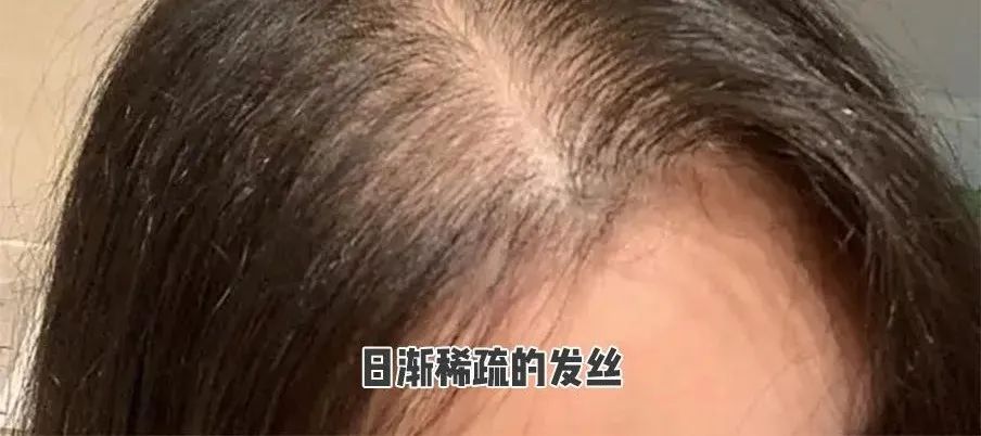 生姜洗发水去屑止痒控油防脱生发,生姜洗发水防脱生发增发效果好吗