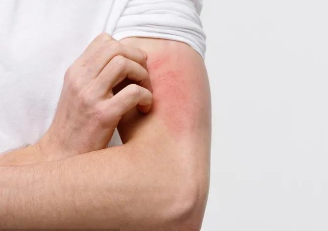 术前药物过敏早期症状,术中过敏反应常见原因和处理