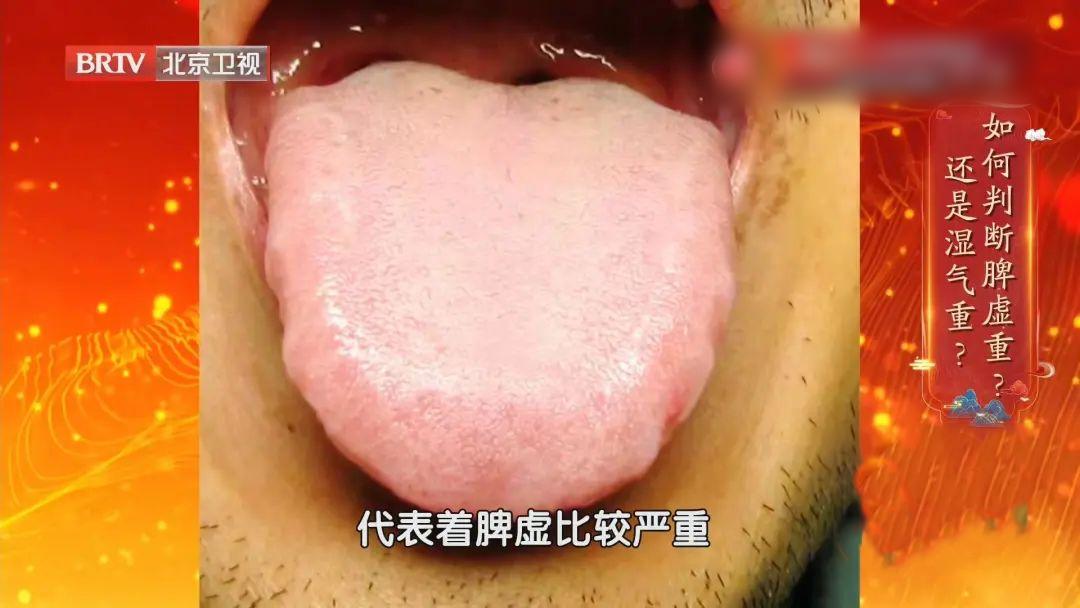 体内湿气重喝什么汤祛湿气,春季湿气重常喝这碗汤能祛湿毒