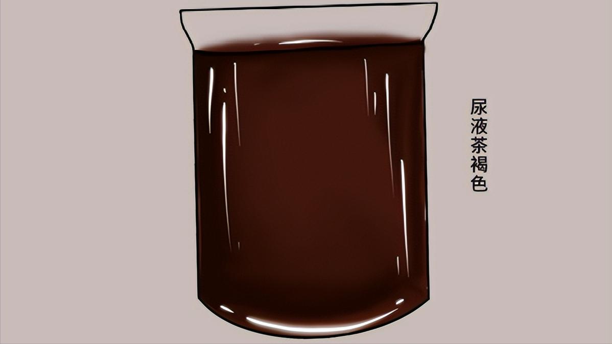 一瓶“甲硝唑”几块钱，或许能“摆平”4种病，不妨了解一下