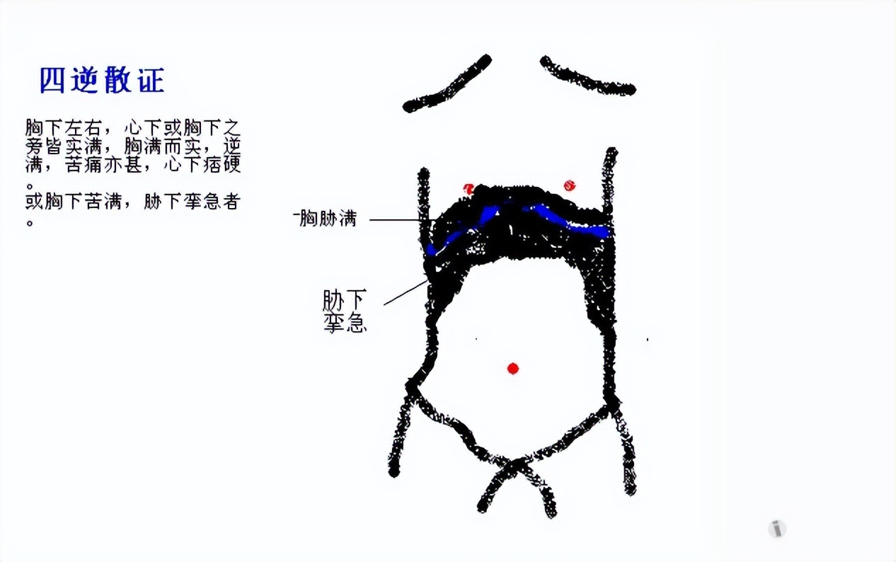 心腹冷痛的食疗方法,上热下寒张仲景五种方剂