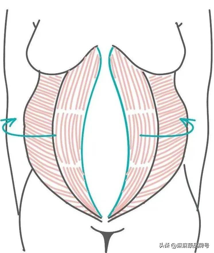 产后腰痛、腹部松垮？一文教你自测与修复腹直肌分离