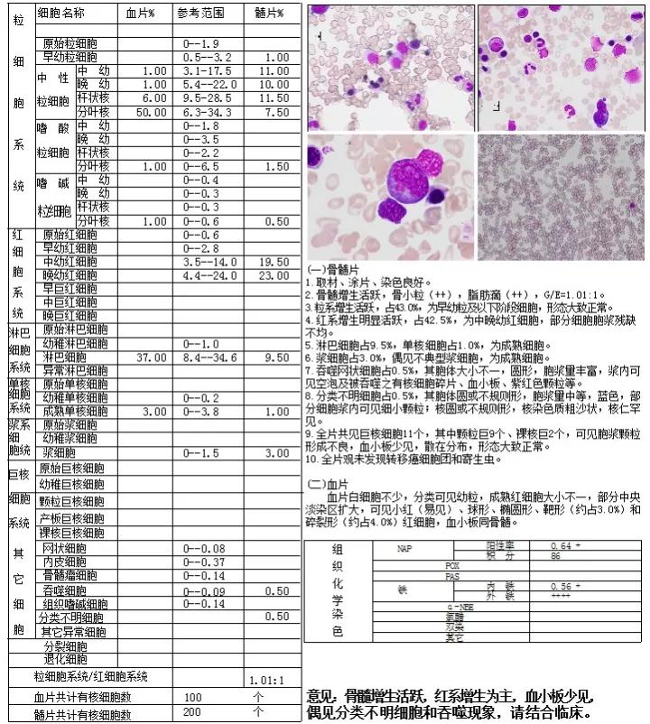 主动脉瓣狭窄病例讨论,25岁主动脉瓣狭窄用什么治疗方案