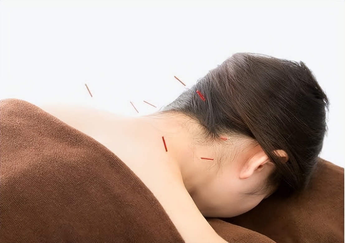 持续性头晕中医能治疗吗,头晕可以要中医调理吗