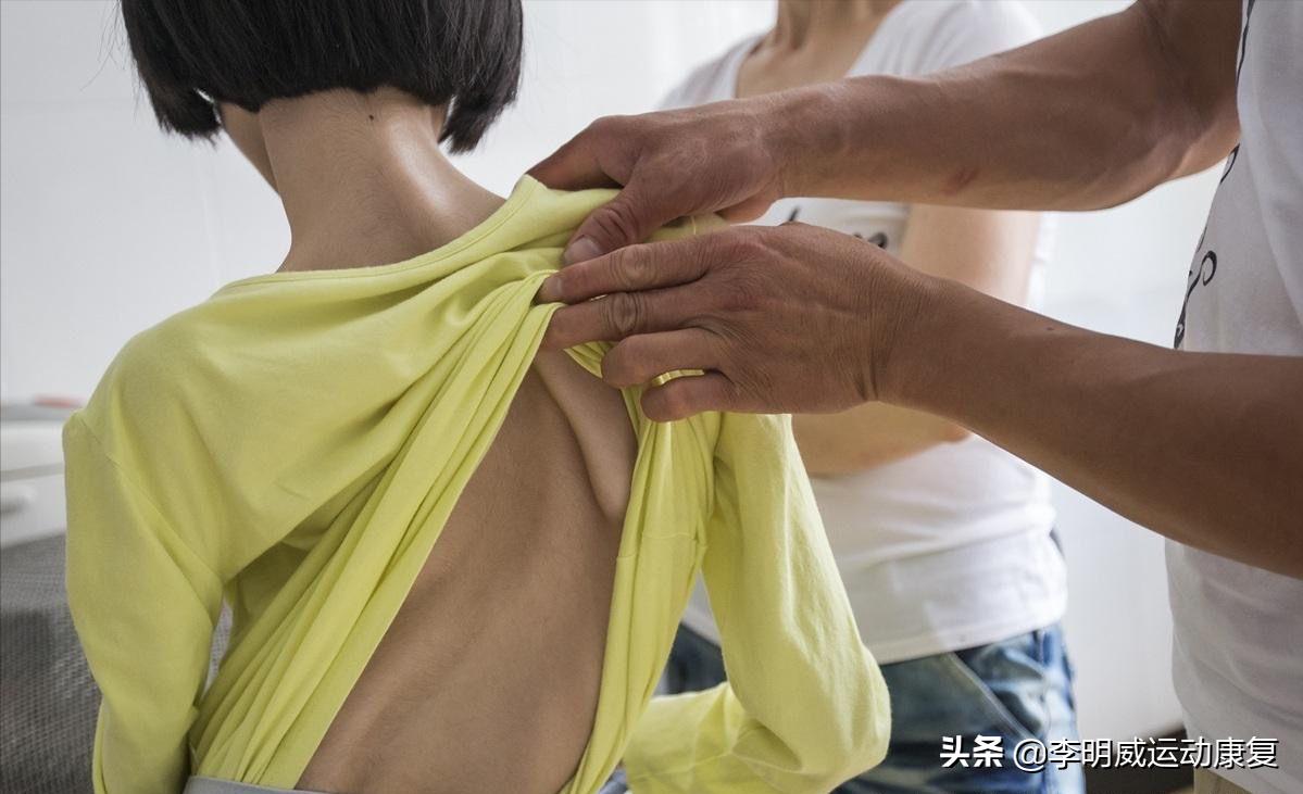 14岁男孩脊柱侧弯怎么训练,14岁女孩脊柱侧弯以后还会加重吗