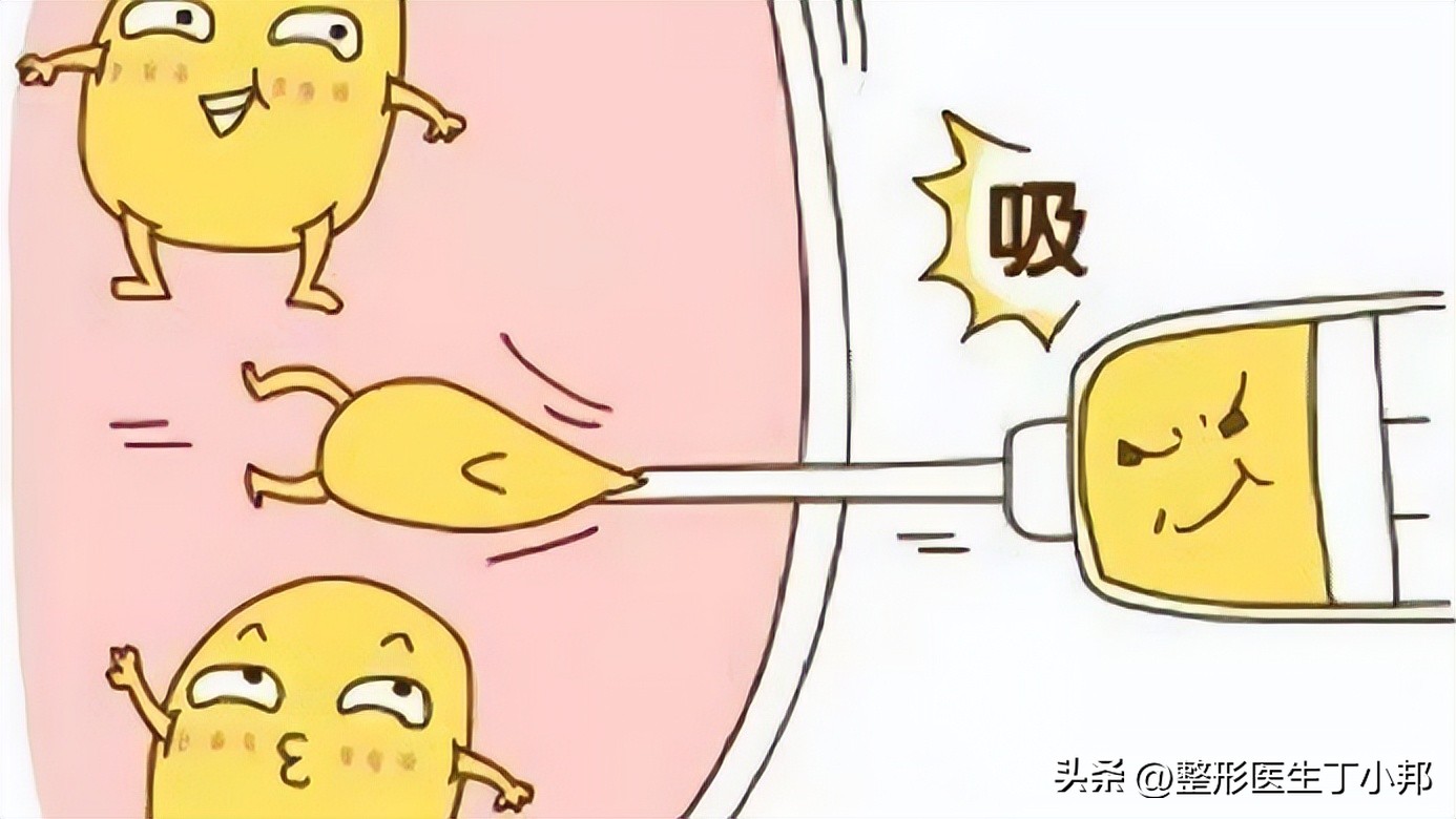 脂肪填充整形知识,脂肪填充修复失败