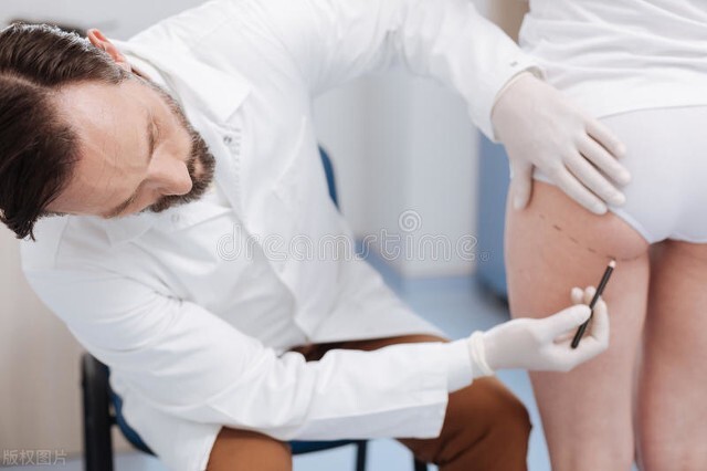 正经科普：肛门不小心被撑大了，还能恢复吗？万一卡住该怎么做？