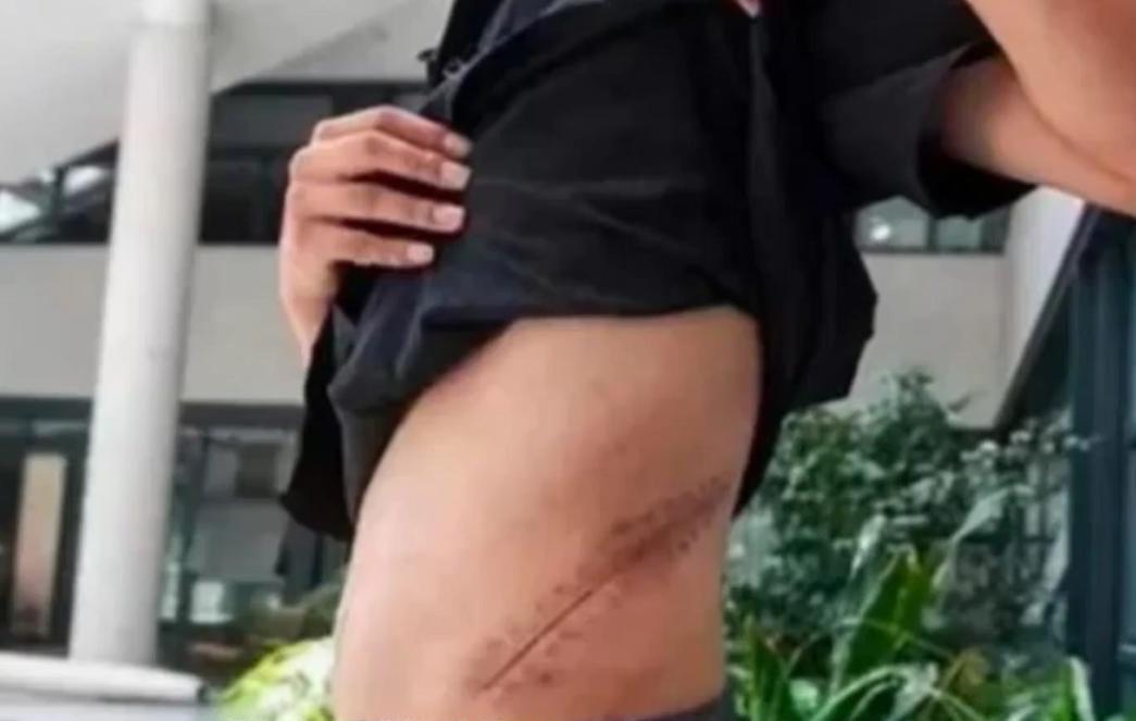 当年卖肾换苹果的少年,当年卖肾换苹果手机的少年