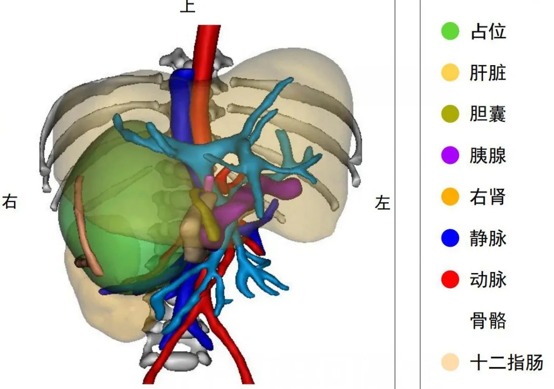 新生儿肾母细胞瘤3.4厘米,50天婴儿脑部长肿瘤66mm